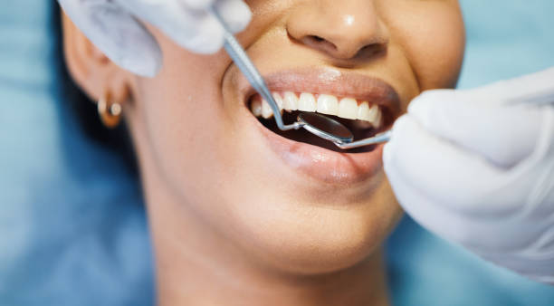 Best Emergency Wisdom Tooth Extraction in Monument Hills, CA