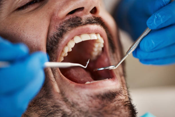 Best Emergency Treatment for Oral Infections in Monument Hills, CA